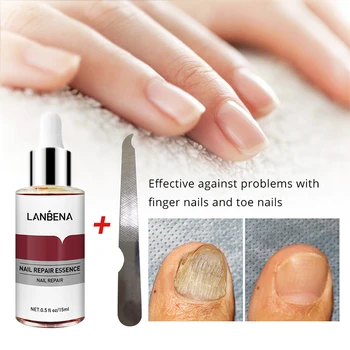15 ML Tırnak Mantar Onarım Özü, Serum, Anti Enfeksiyon Paronisi erkekler kadınlar ve Tedavisi Bakımı Ayak Tırnak Mantarı Temizleme Jeli